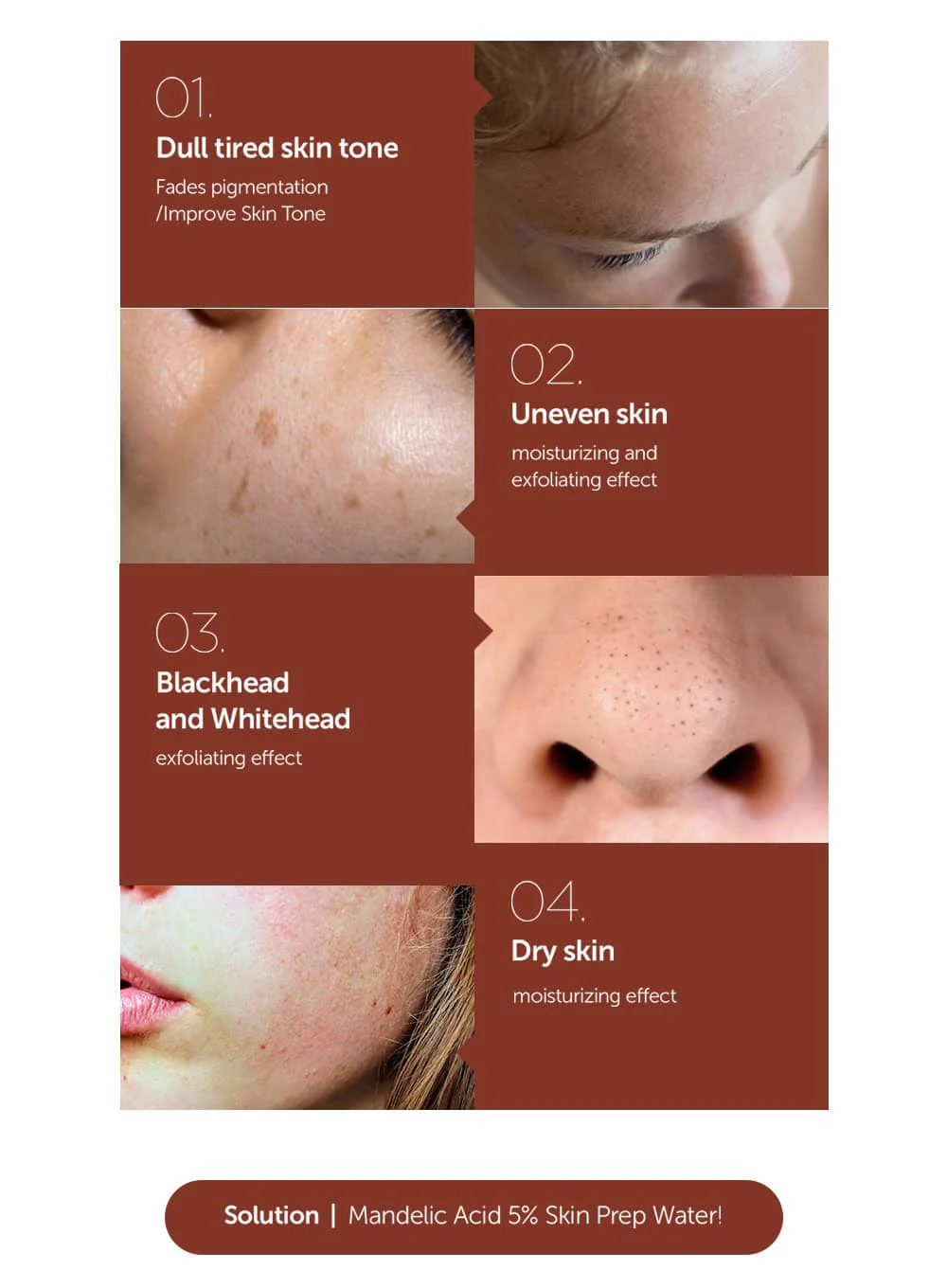 Mandelic Acid 5% Skin Prep Water (120ml) - Image 3